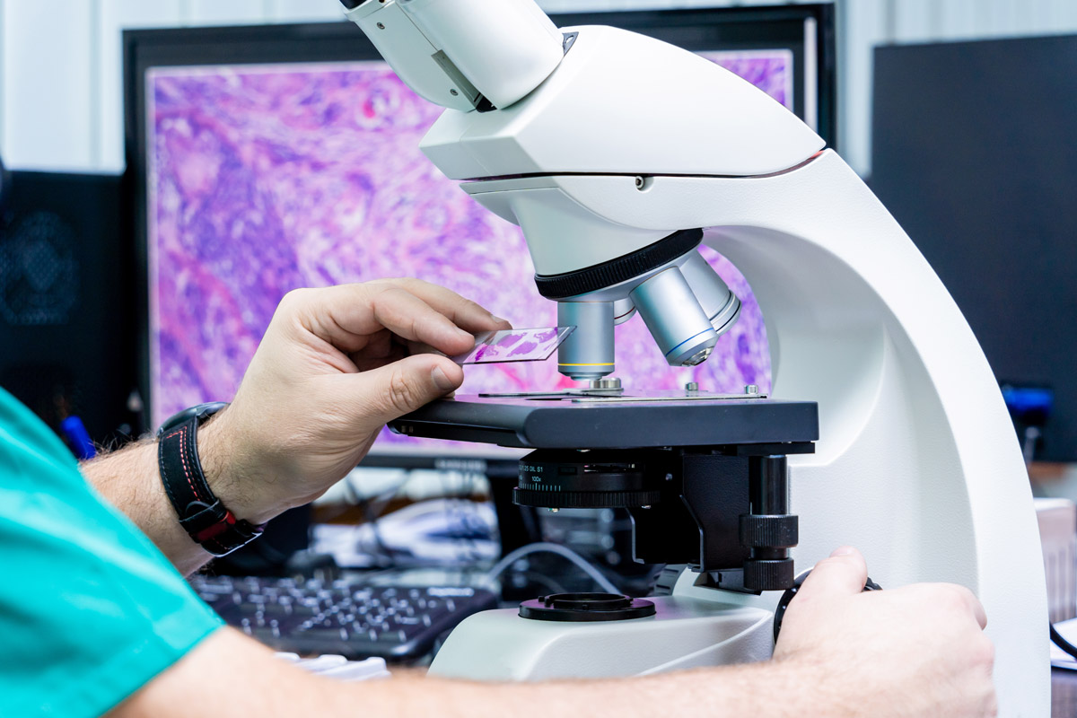 An image of a pathologist examining a slide under a microscope. An image of a pathologist examining a slide under a microscope.